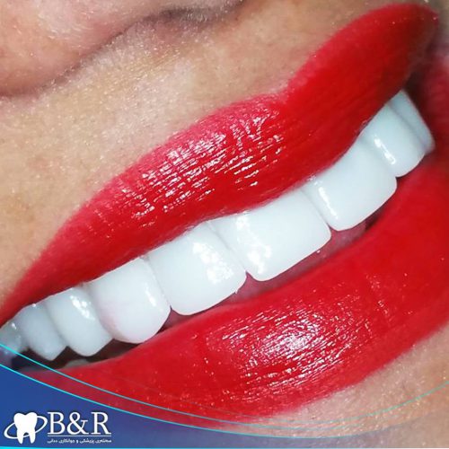 teeth fixed by B&R